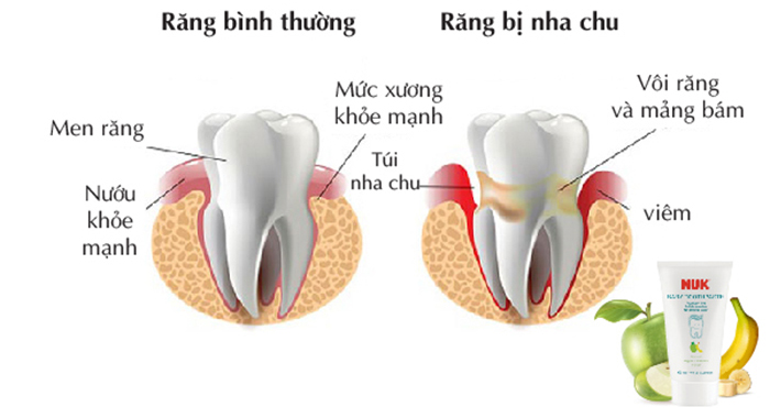Kem danh rang tre em khong flouride Nuk NU21425 50ml
